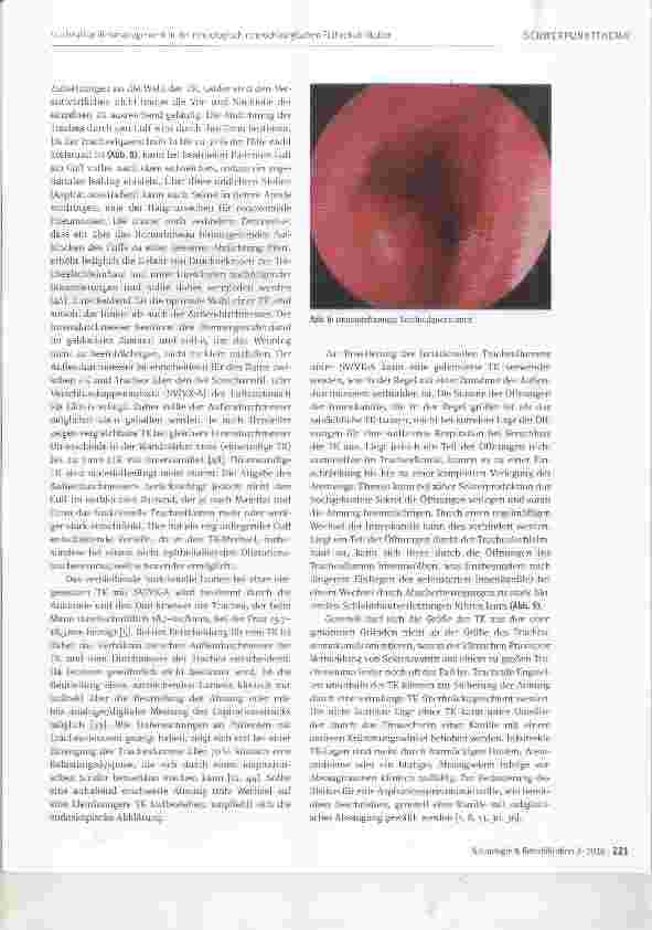 Vorschauseite 5: Trachealkanülenmanagement in der neurologisch-neurochlrurgischen Frührehabilitation