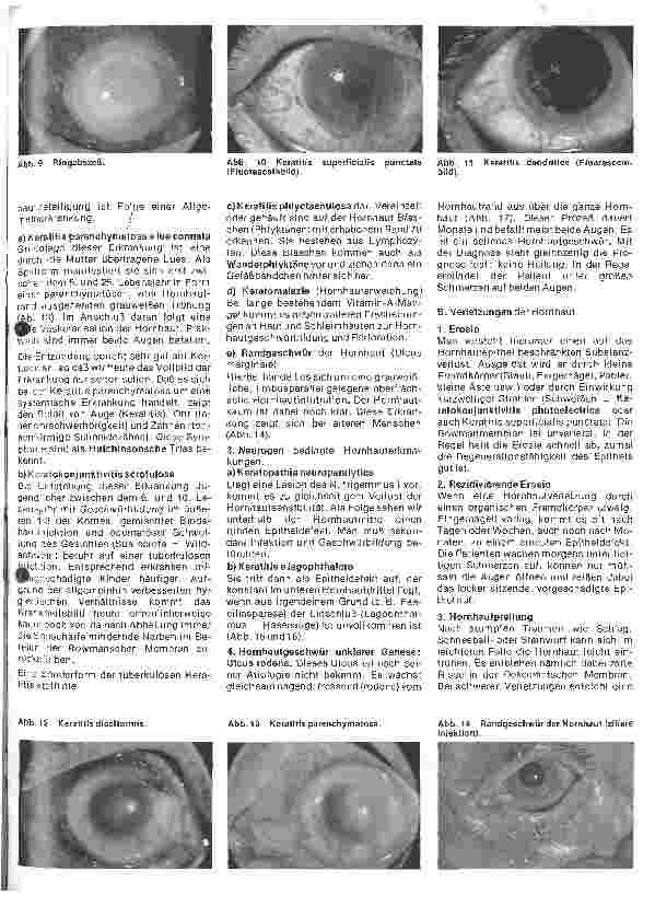 Vorschauseite 4: Einführung in die Augenheilkunde 5. Folge: Die Hornhaut
