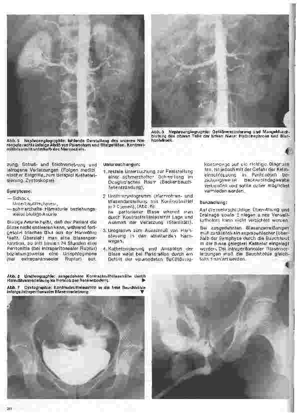 Vorschauseite 3: Urologie 12. Folge: Verletzungen des Urogenitalsystems