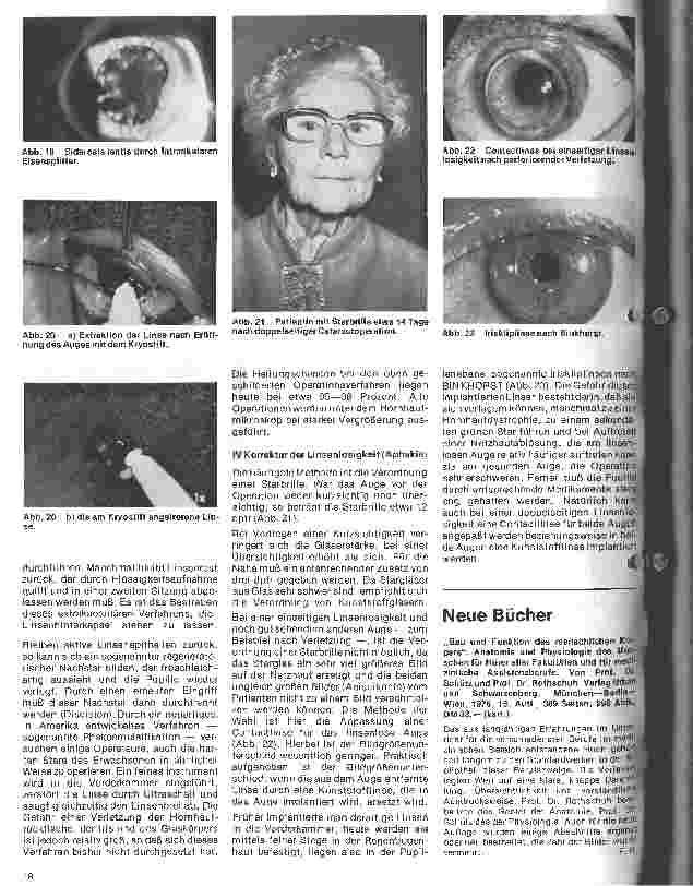 Vorschauseite 5: Einführung in die Augenheilkunde 6. Folge: Erkrankungen der Linse