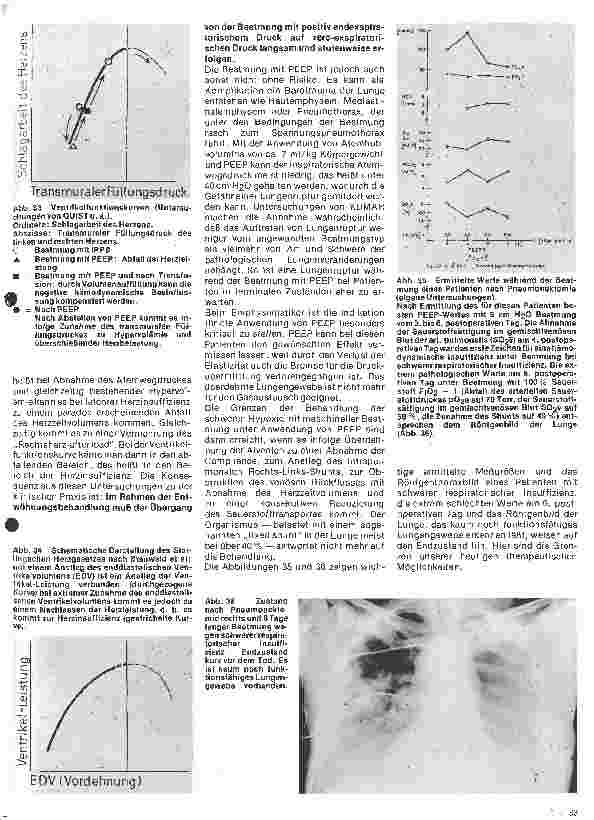 Vorschauseite 2: Aktuelle Themen aus Intensivmedizin und Anästhesiologie Die künstliche Beatmung (Fortsetzung)