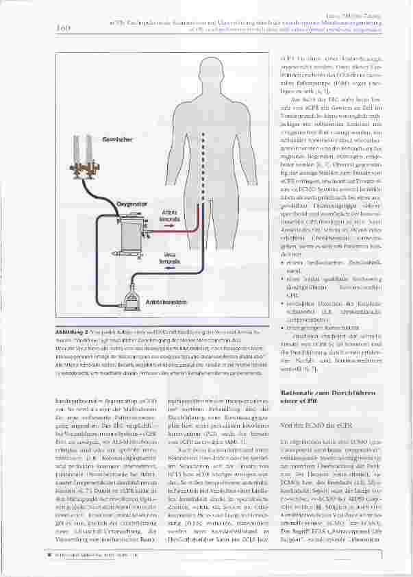 Vorschauseite 4: eCPR: Kardiopulmonale Reanimation mit Unterstützung durch die extrakorporale Membranoxygenierung