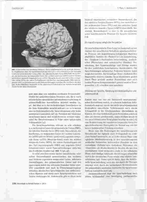 Vorschauseite 2: Rehabilitation der Sprache nach einem Schlaganfall