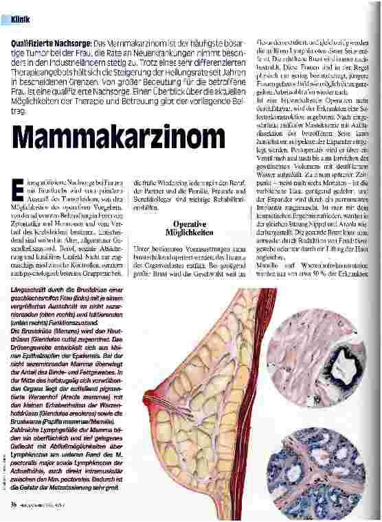 Vorschauseite 1: Mammakarzinom