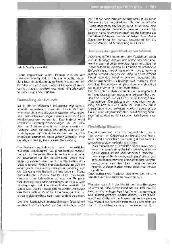 Vorschauseite 3: Ballonruptur an einem aufbereiteten Woodbridge-Tubus