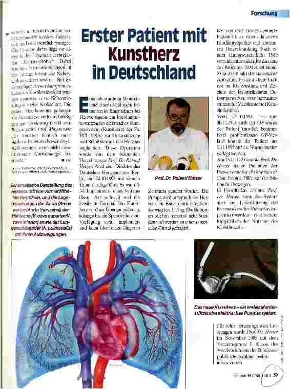 Vorschauseite 1: Erster Patient mit Kunstherz in Deutschland