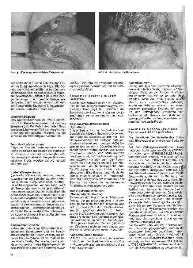 Vorschauseite 3: Zahn-Mundund Kieferchirurgie 11. Folge: Tumoren (II bösartig)