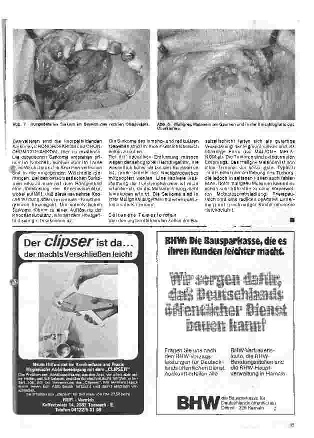 Vorschauseite 4: Zahn-Mundund Kieferchirurgie 11. Folge: Tumoren (II bösartig)