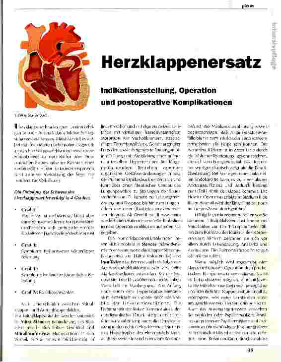 Vorschauseite 1: Herzklappenersatz