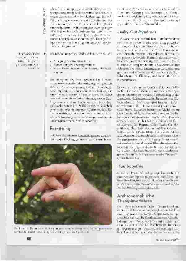Vorschauseite 5: Feuer im Darm Morbus Crohn und Colitis ulcerosa