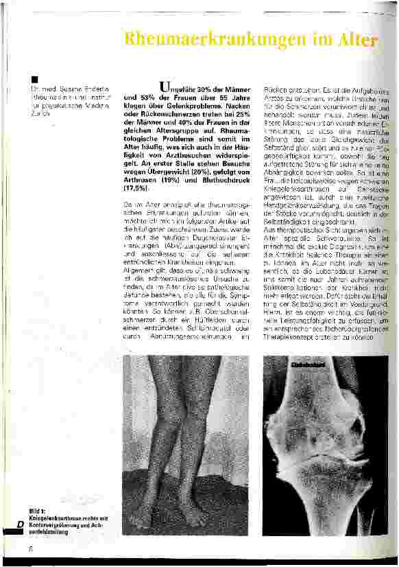 Vorschauseite 1: Rheumaerkrankungen im Alter