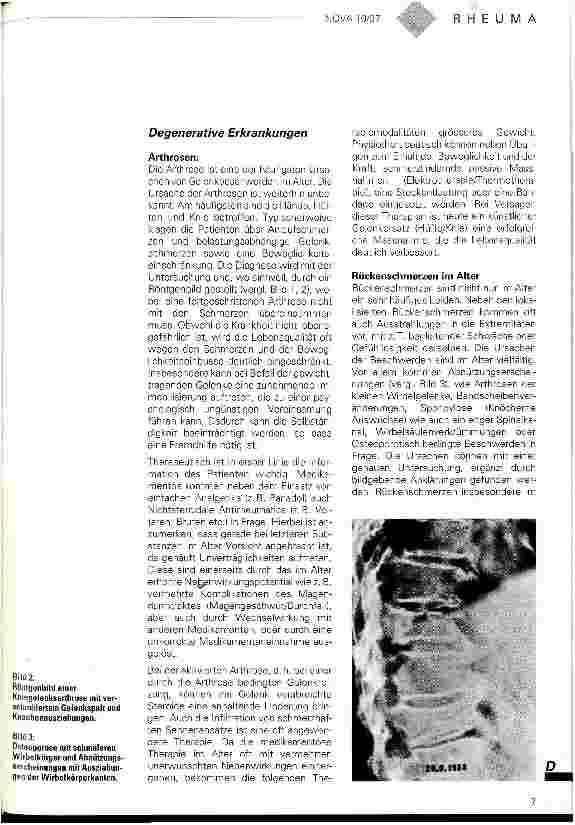 Vorschauseite 2: Rheumaerkrankungen im Alter