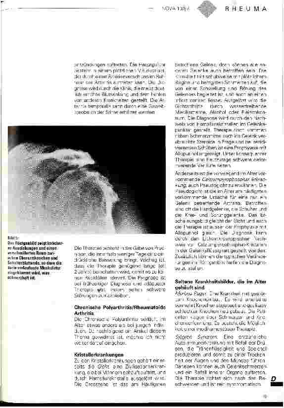 Vorschauseite 4: Rheumaerkrankungen im Alter