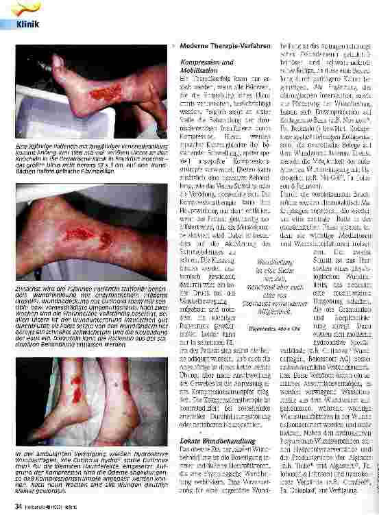 Vorschauseite 3: Vom Aberglauben zum High-Tech-Verband Neues in der Ulcus-cruris-venosum-Behandlung