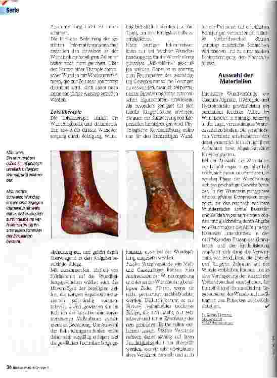 Vorschauseite 2: Wundversorgung in der Pflege Aktuelle Therapierichtlinien zur Versorgung chron. Hautulzera