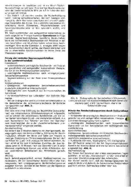 Vorschauseite 4: Erkrankungen und Schäden der Wirbelsäule im Erwachsenenalter