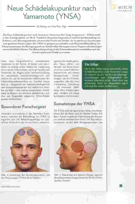 Vorschauseite 1: Neue Schädelakupunktur nach Yamamoto (YNSA)