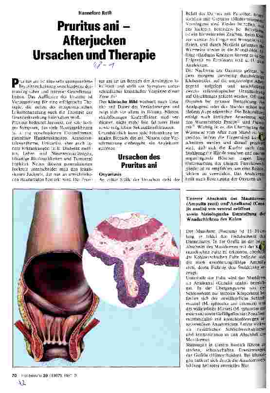 Vorschauseite 1: Pruritus ani - Afterjucken Ursachen und Therapie