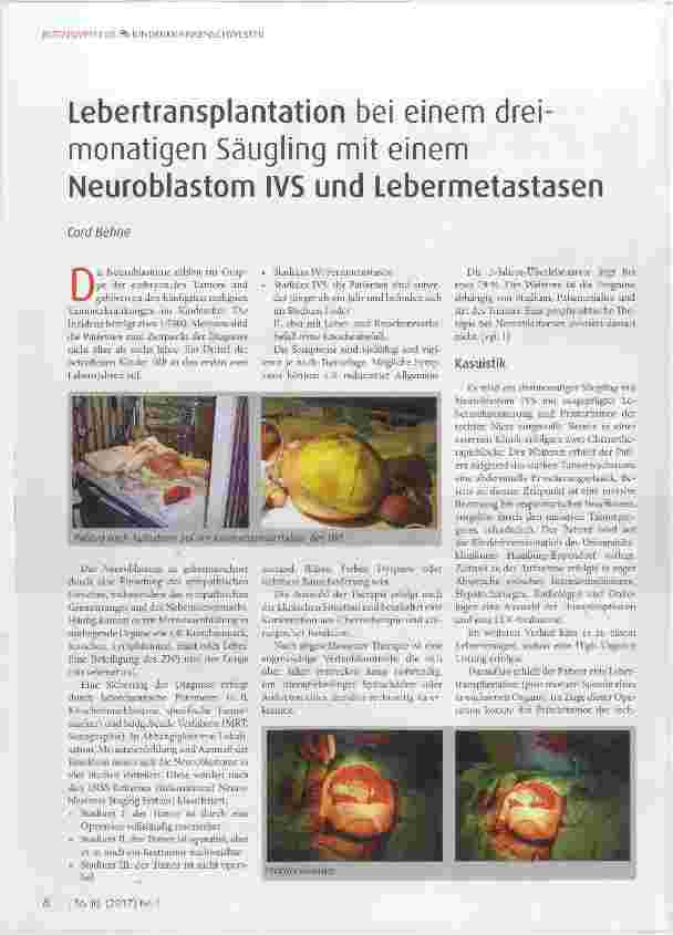 Vorschauseite 1: Lebertransplantation bei einem dreimonatigen Säugling mit einem Neuroblastom IVS und Lebermetastasen