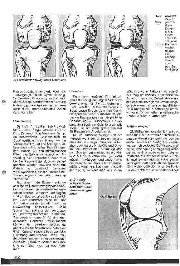 Vorschauseite 2: Arthrosen/Verlauf u. Therapie/1. Interdisziplinäres Arthroseforum, München, 19. 06. 86 der Opfermann Arzneimittel GmbH, Bergisch-Gladbach