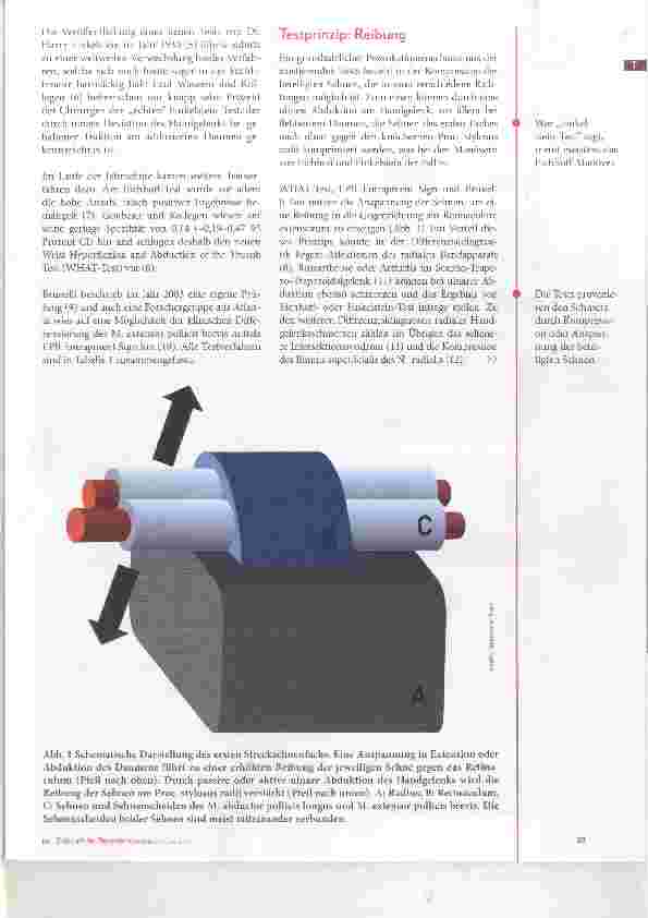 Vorschauseite 2: Radialer Schmerz in Daumen und Handgelenk