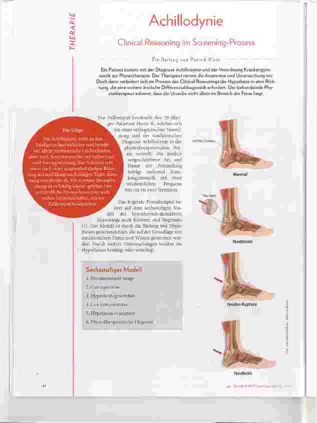 Vorschauseite 1: Achillodynie Clinical Reasoning im Screening-Prozess