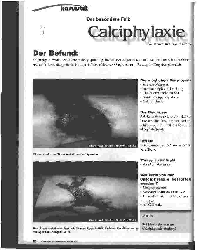 Vorschauseite 1: Der besondere Fall: Calciphylaxie