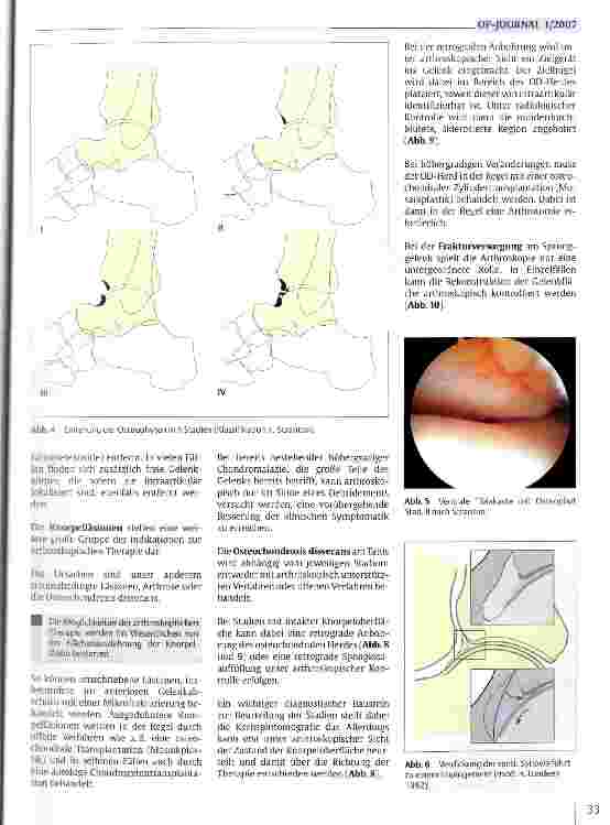 Vorschauseite 4: Arthroskopie an Ellenbogengelenk und oberem Sprunggelenk