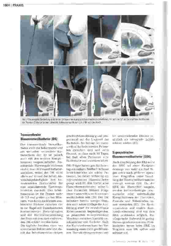 Vorschauseite 3: Katheterdrainage der Harnblase