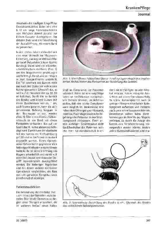 Vorschauseite 2: Laparoskopische gastric banding Operation zur Behandlung der krankhaften Fettsucht