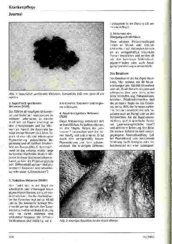 Vorschauseite 3: Hautkrebs - Früherkennung und Vorsorge