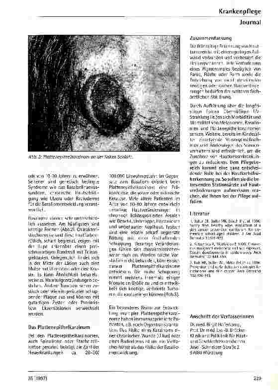 Vorschauseite 4: Hautkrebs - Früherkennung und Vorsorge