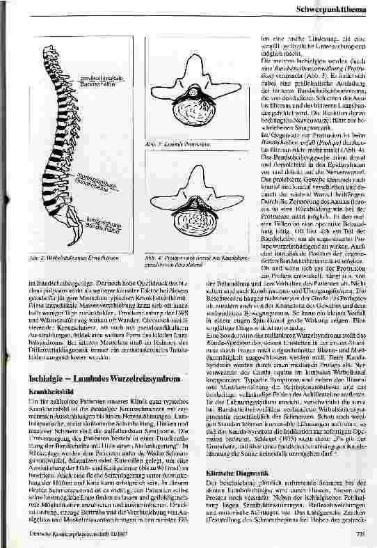 Vorschauseite 2: Lumbago, Ischialgie und lumbaler Bandscheibenvorfall