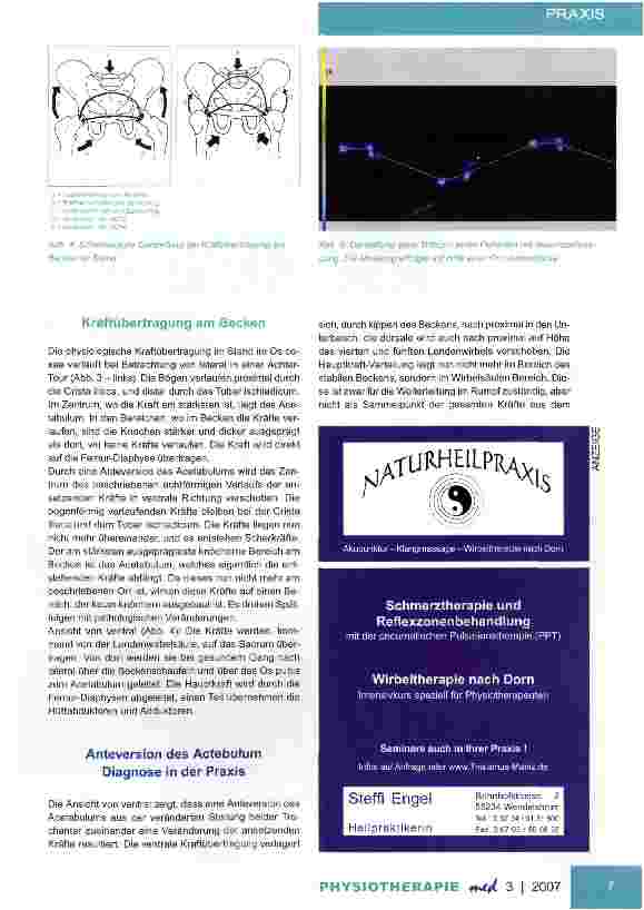 Vorschauseite 3: Der InnenrotationsgangSpezielle Ursache Anteversion des Acetabulums