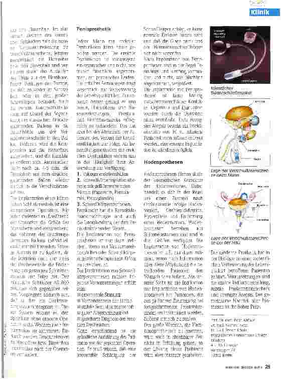 Vorschauseite 2: Prothetik in der Urologie