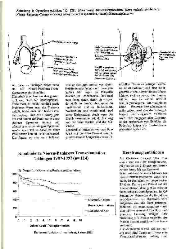 Vorschauseite 5: Organtransplantationen Vortrag am 25. März 1998 im Paul-Lechler-Krankenhaus, Tübingen