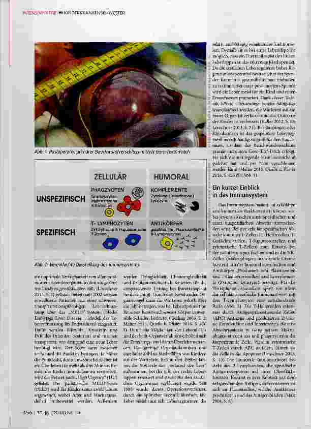 Vorschauseite 2: Freund und Feind zugleich: Immunsuppression nach pädiatrischer Lebertransplantation