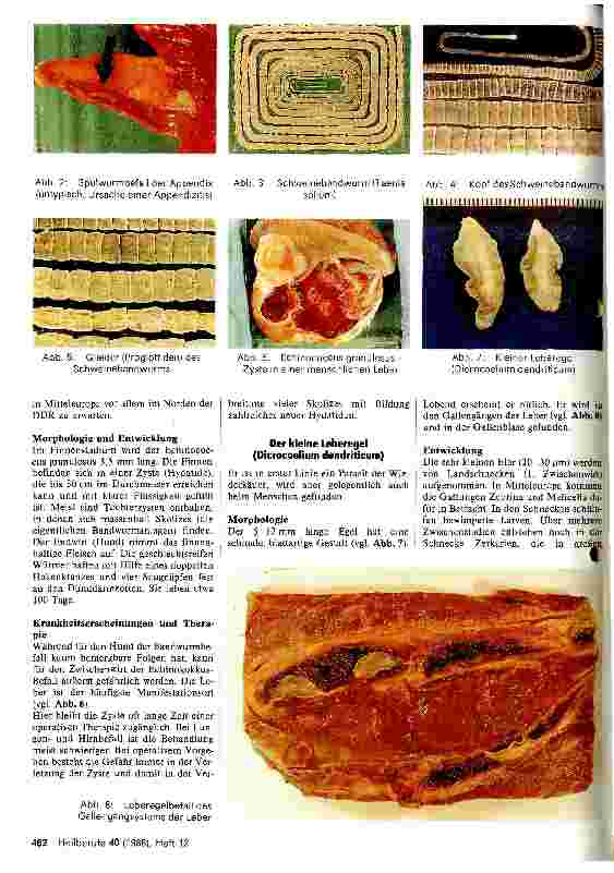 Vorschauseite 2: Parasiten des Menschen