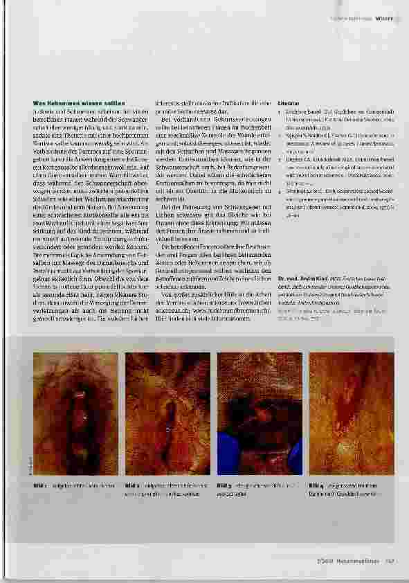 Vorschauseite 4: Oft unerkannt: Lichen sclerosus