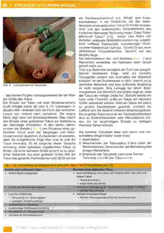 Vorschauseite 4: Management des kindlichen Atemwegs