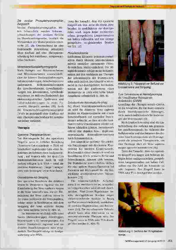 Vorschauseite 3: Diagnostik und Therapie der Varikosis