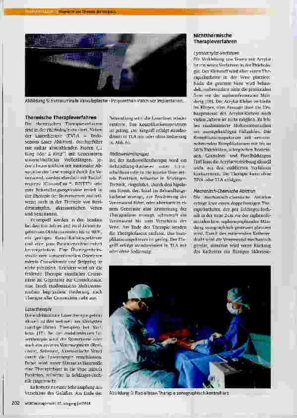 Vorschauseite 4: Diagnostik und Therapie der Varikosis
