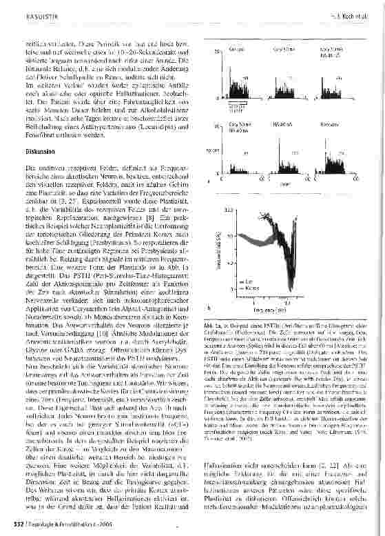 Vorschauseite 3: Isoliertes akustisches »Alice-im-Wunder-land-Syndrom« als Begleitsymptom eines Gelegenheitsanfalls