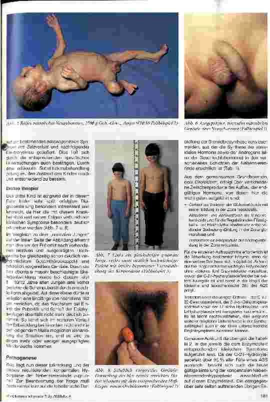 Vorschauseite 2: Adrenogenitales Syndrom Diagnostik und Therapie bei Jungen und Mädchen