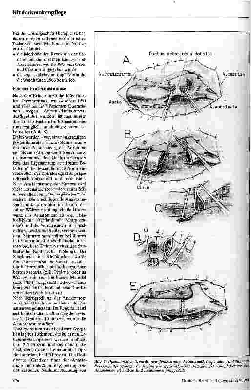 Vorschauseite 4: Die Aortenisthmusstenose