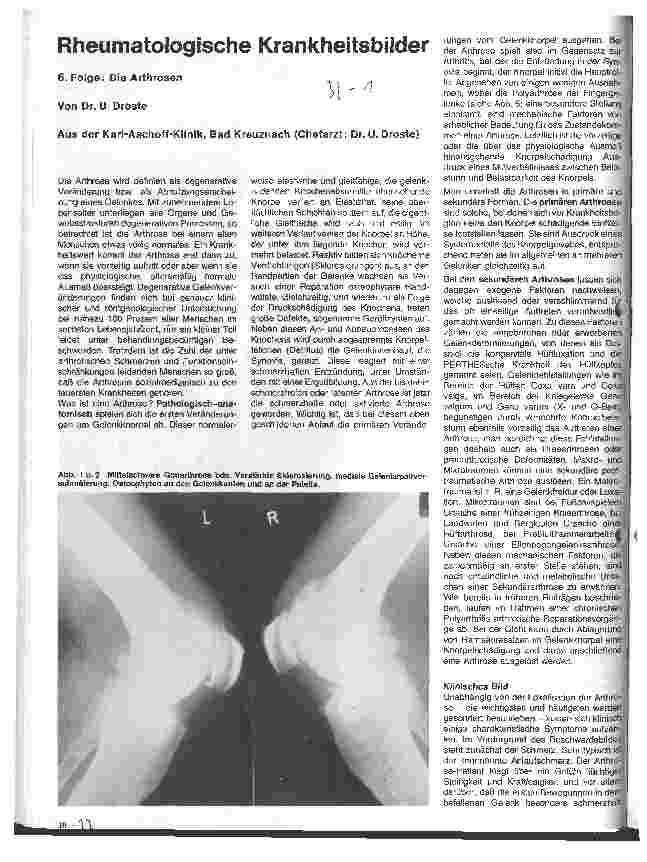 Vorschauseite 1: Rheumatologische Krankheitsbilder 6. Folge: Die Arthrose