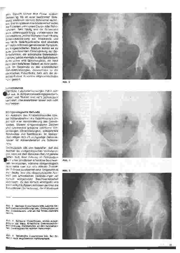 Vorschauseite 2: Rheumatologische Krankheitsbilder 6. Folge: Die Arthrose
