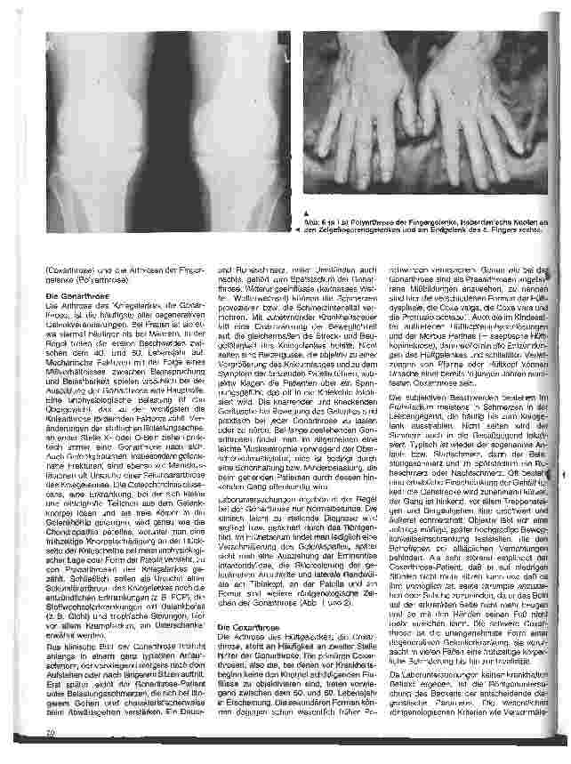 Vorschauseite 3: Rheumatologische Krankheitsbilder 6. Folge: Die Arthrose