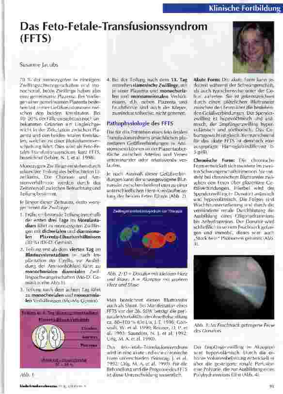Vorschauseite 1: Das Feto-Fetale-Transfusionssyndrom (FFTS)