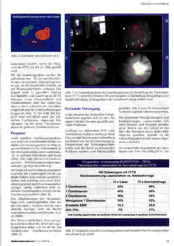 Vorschauseite 4: Das Feto-Fetale-Transfusionssyndrom (FFTS)